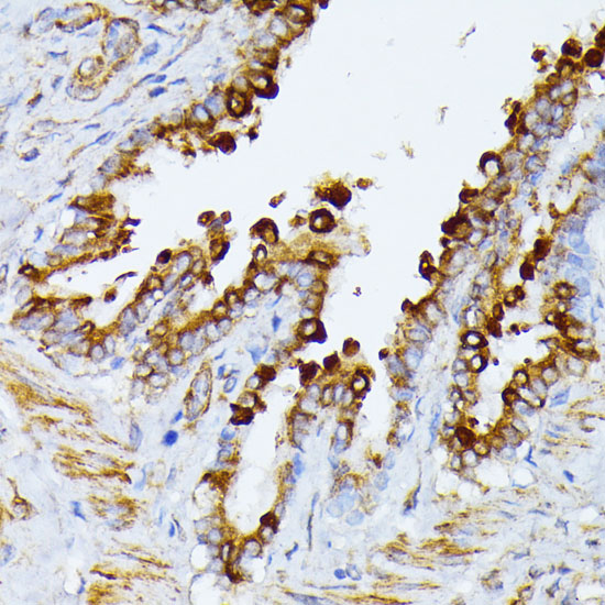 ITPR2 Polyclonal Antibody (E-AB-92150)