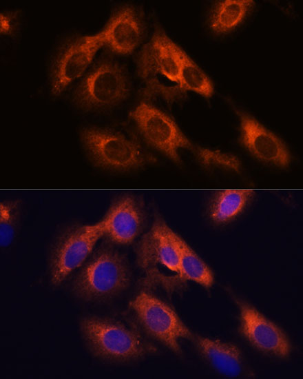 RAPH1 Polyclonal Antibody (E-AB-65342)