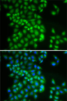 YTHDC1 Polyclonal Antibody (E-AB-62555)