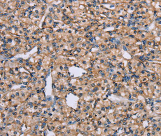 ADAM29 Polyclonal Antibody (E-AB-12946)