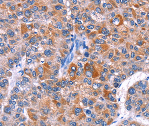 ELP2 Polyclonal Antibody (E-AB-10941)