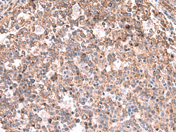 KBTBD11 Polyclonal Antibody (E-AB-52073)