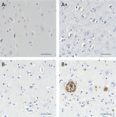 Purified anti-β-Amyloid, 1-16 Recombinant Antibody (618251)
