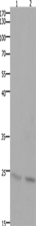 HMGB3 Polyclonal Antibody (E-AB-15718)