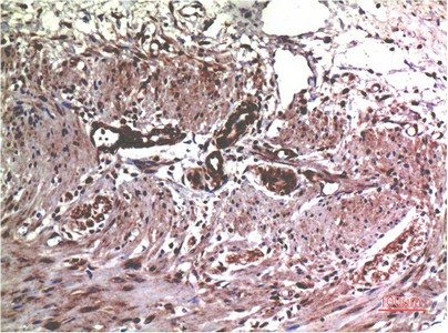 MMP2 Monoclonal Antibody (E-AB-22242)