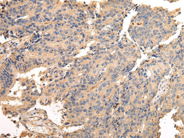 SDCBP Polyclonal Antibody (E-AB-17210)