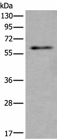 SCP2 Polyclonal Antibody (E-AB-52211)