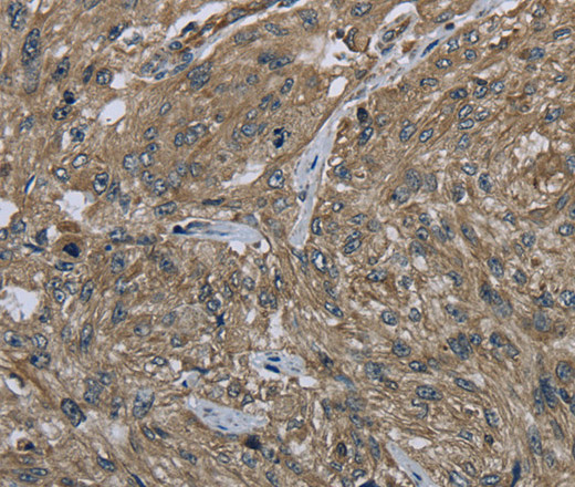CLPS Polyclonal Antibody (E-AB-14880)