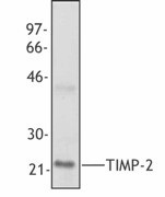 Purified anti-TIMP-2 Antibody (635401)