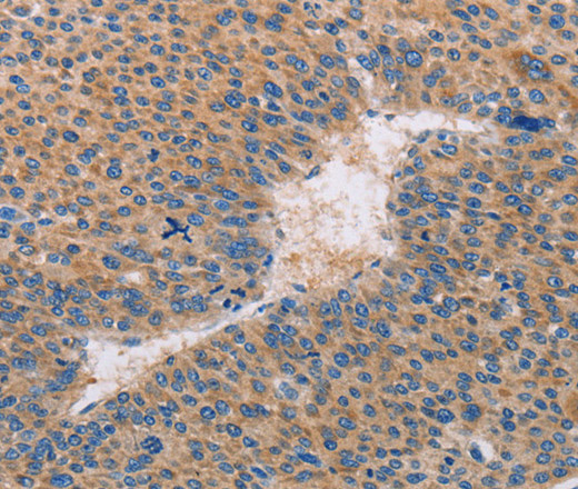 CASP10 Polyclonal Antibody (E-AB-13820)