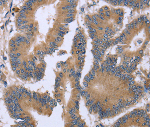 KIAA1324 Polyclonal Antibody (E-AB-14983)