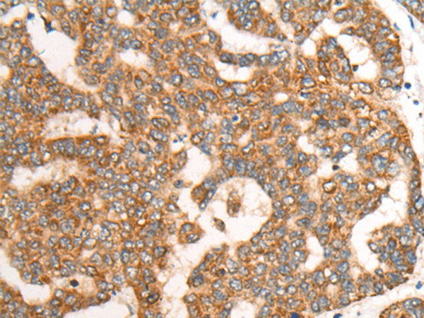 CDON Polyclonal Antibody (E-AB-18603)