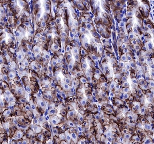 Recombinant Claudin 18.2 Monoclonal Antibody (AN301831L)