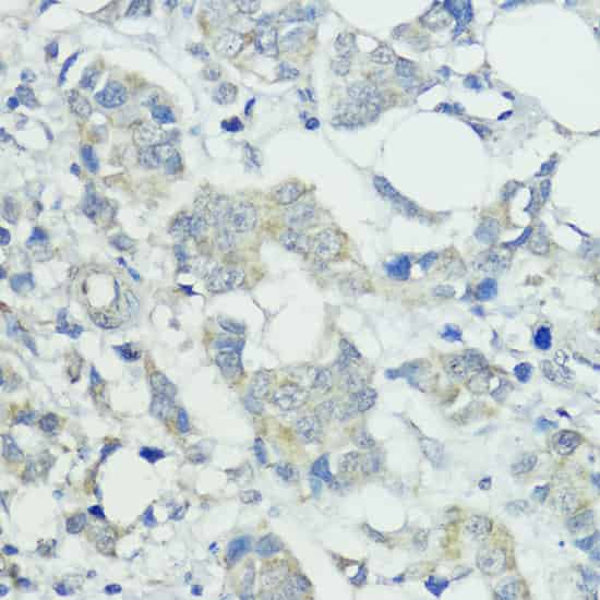 SOCS5 Polyclonal Antibody (E-AB-65566)