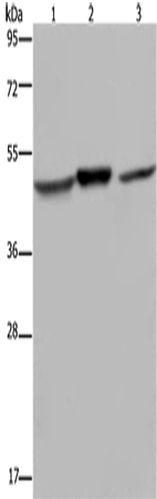 NDUFS2 Polyclonal Antibody (E-AB-16636)