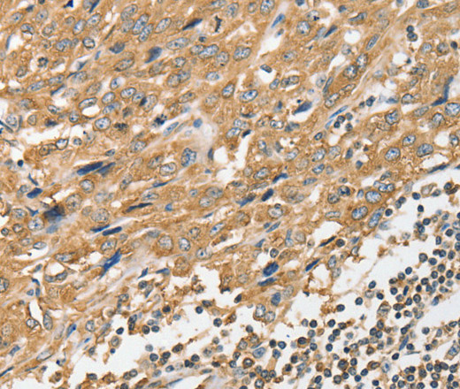 ANGPTL7 Polyclonal Antibody (E-AB-14566)