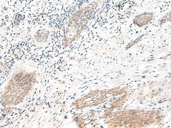 ARL2BP Polyclonal Antibody (E-AB-52822)