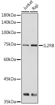 IL2RB Polyclonal Antibody (E-AB-92708)