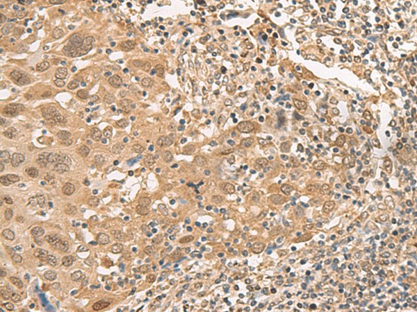 ISCU Polyclonal Antibody (E-AB-52700)