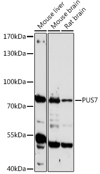 PUS7 Polyclonal Antibody (E-AB-91879)