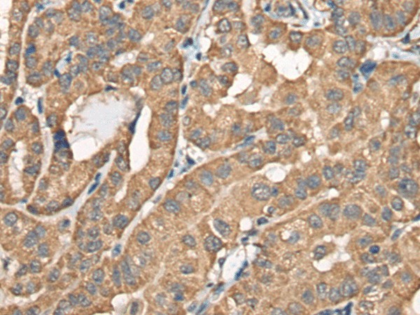 BCHE Polyclonal Antibody (E-AB-18553)
