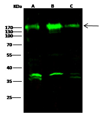 Recombinant Nicastrin/NCSTN Monoclonal Antibody (AN300391P)
