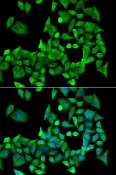 PPP2R1A Polyclonal Antibody (E-AB-61121)
