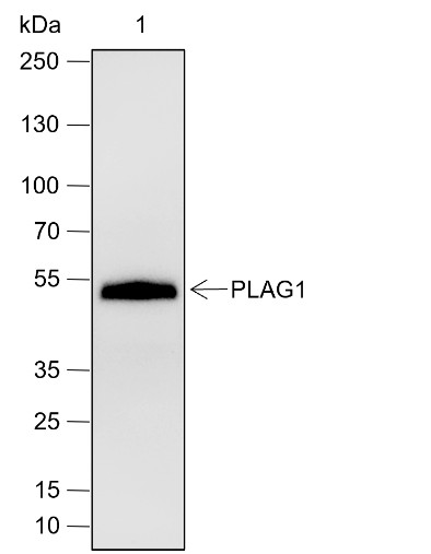 Recombinant PLAG1 Monoclonal Antibody (AN301944L)