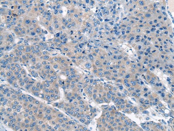 CITED4 Polyclonal Antibody (E-AB-19707)