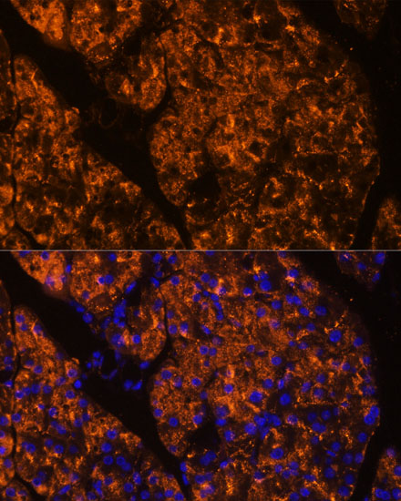 SERPINI2 Polyclonal Antibody (E-AB-65836)