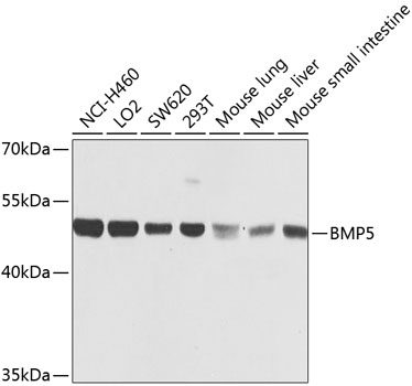 BMP5 Polyclonal Antibody (E-AB-62013)