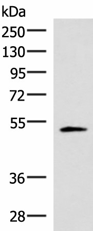 IRX1 Polyclonal Antibody (E-AB-52040)