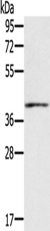 IFNGR2 Polyclonal Antibody (E-AB-13321)