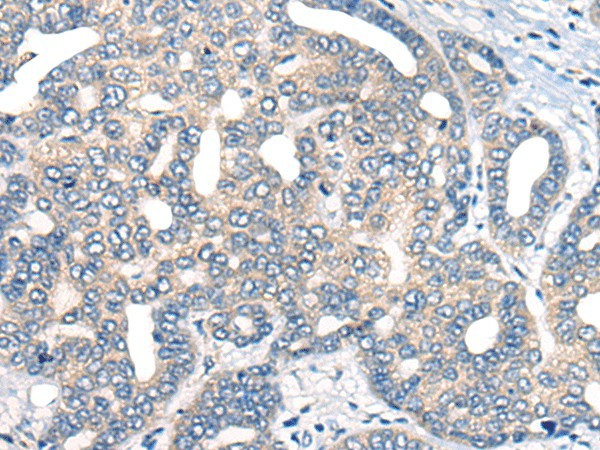 AURKA Polyclonal Antibody (E-AB-19747)
