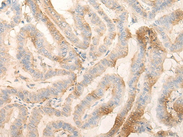 MPPED2 Polyclonal Antibody (E-AB-52595)