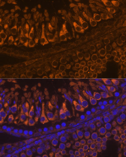 ELSPBP1 Polyclonal Antibody (E-AB-66612)