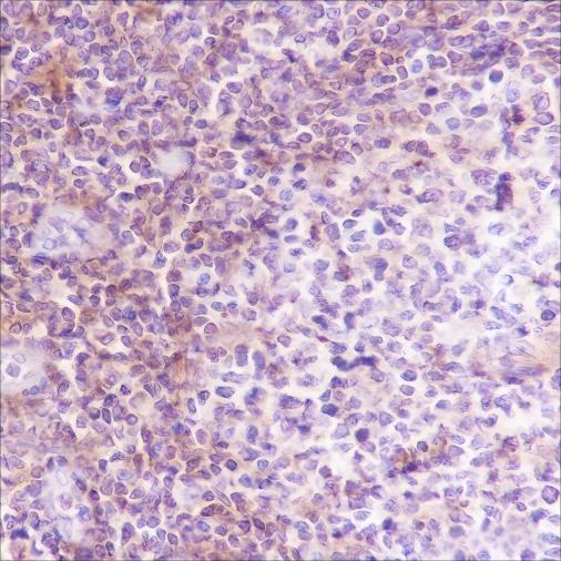 Recombinant VPAC2 Monoclonal Antibody (AN301688L)