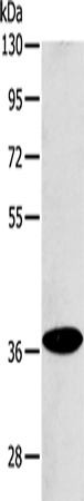 ACMSD Polyclonal Antibody (E-AB-10712)