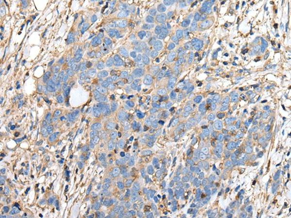PLA2G16 Polyclonal Antibody (E-AB-53452)