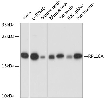 RPL18A Polyclonal Antibody (E-AB-66998)