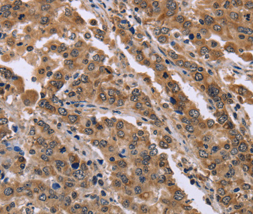 FAM3B Polyclonal Antibody (E-AB-11214)
