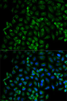 Beta-TRCP Polyclonal Antibody (E-AB-60396)