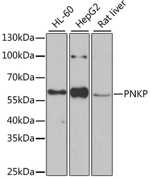 PNKP Polyclonal Antibody (E-AB-61302)