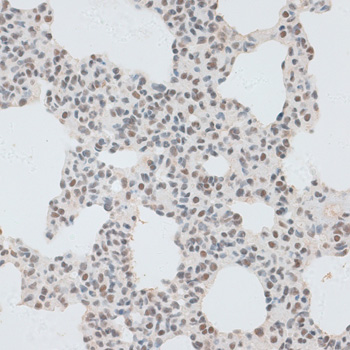 ZNF148 Polyclonal Antibody (E-AB-61458)