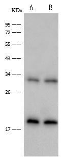 Interferon Gamma Monoclonal Antibody (AN200215P)