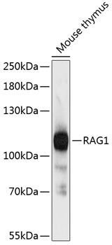 RAG1 Polyclonal Antibody (E-AB-65946)