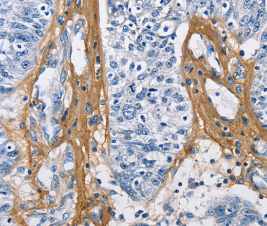 COL3A1 Polyclonal Antibody (E-AB-14010)