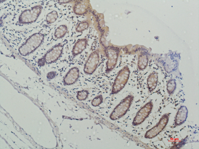 Galectin 3 Monoclonal Antibody (E-AB-22190)