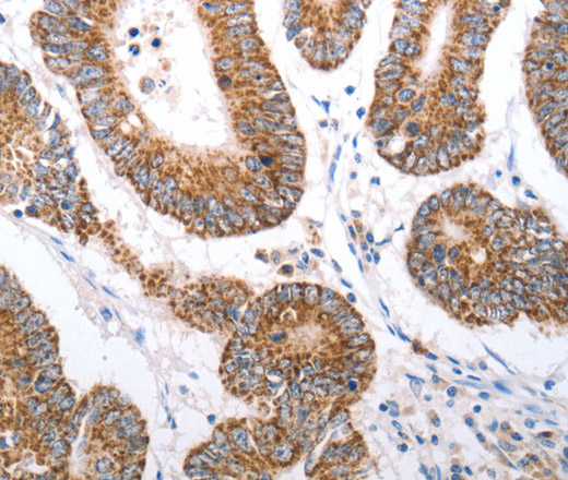 HCRTR1 Polyclonal Antibody (E-AB-12828)
