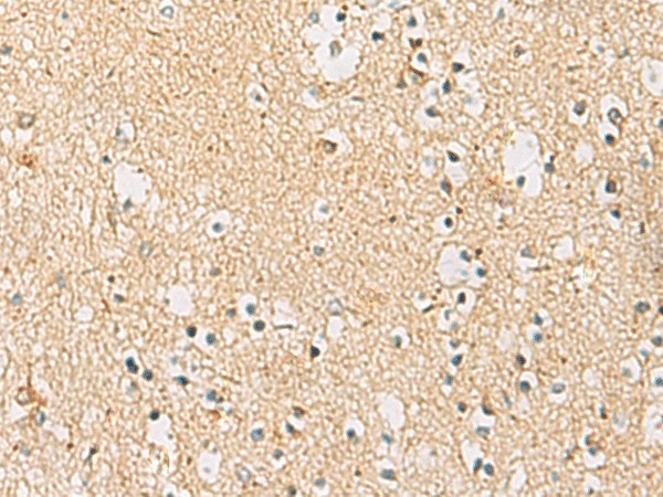 IDS Polyclonal Antibody (E-AB-53138)